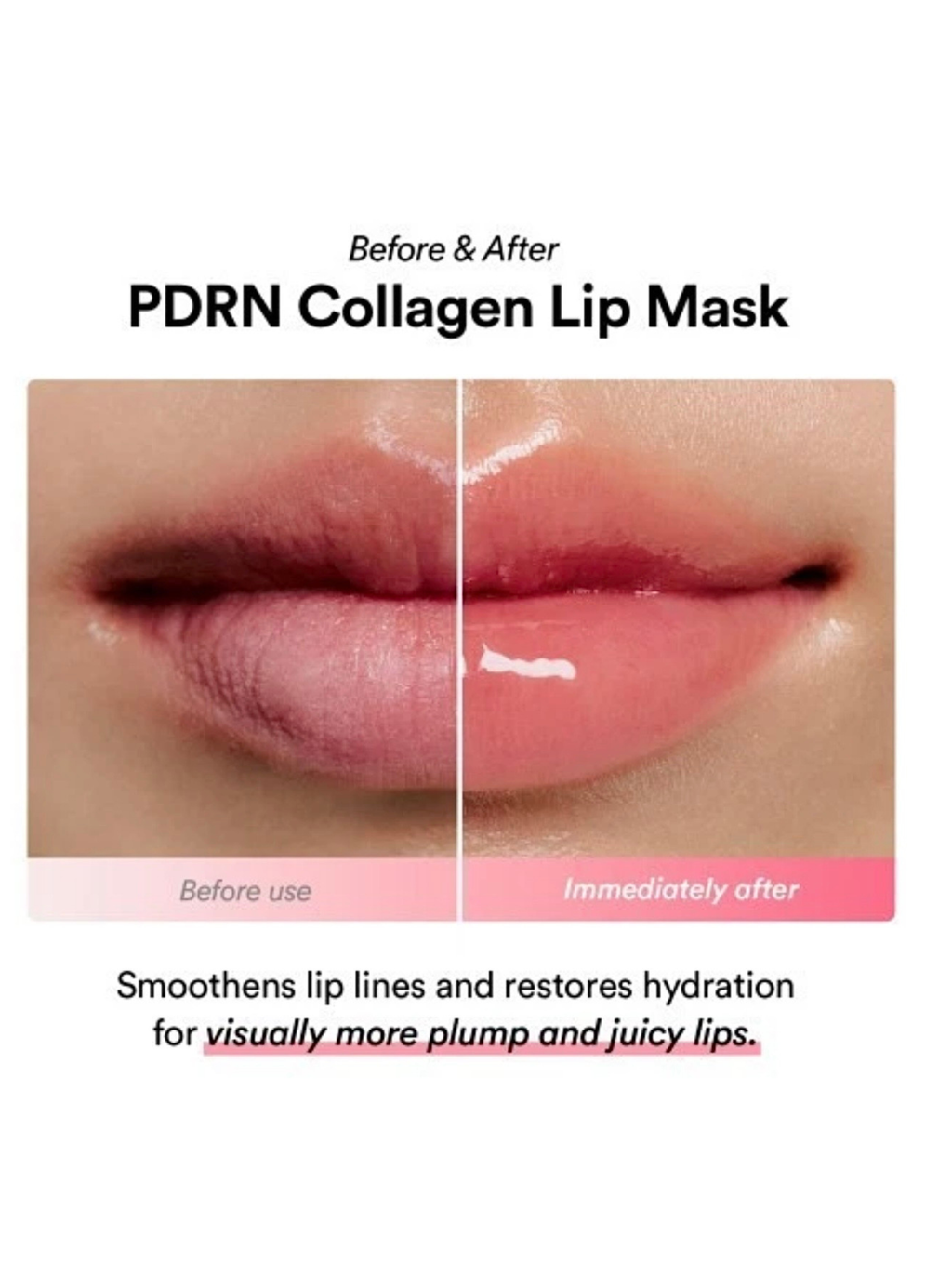 ABIB – PDRN Collagen Lip Mask Glazed Jelly, 11g